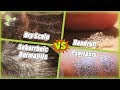 Dry Scalp -vs- Dandruff -vs- Seborrheic Dermatitis -vs- Psoriasis