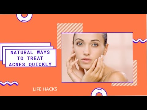 7 NATURAL WAYS TO TREAT ACNE QUICKLY|3 EFFECTIVE MASK FOR GLOWING SKIN
