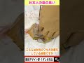 【閲覧注意】ワキガ治療の手術を大公開!! #Shorts