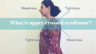 What is upper crossed syndrome Text syndrome  Easy explaination