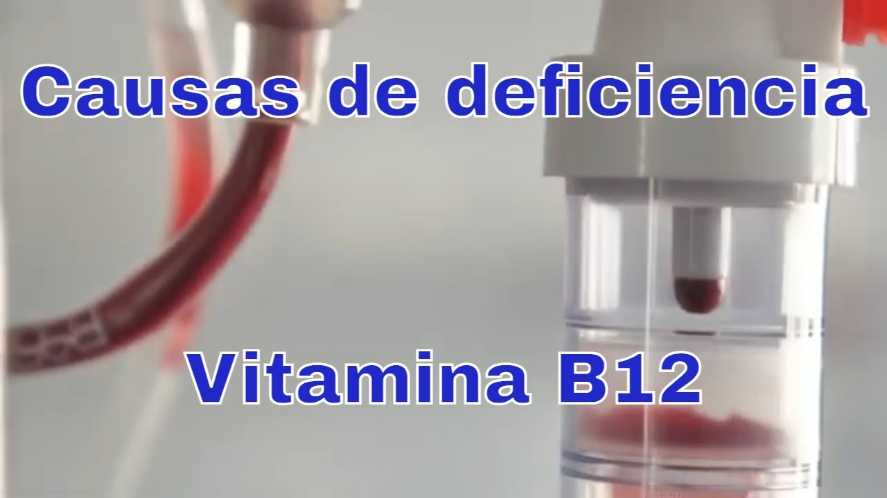 5 Causas de deficiencia de vitamina B12 YouTube