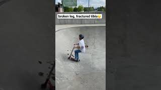 scooter crash broken leg