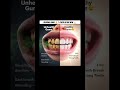 unhealthy gums🤮 VS healthy gums✨ #dental #dentist #health #teethdecay