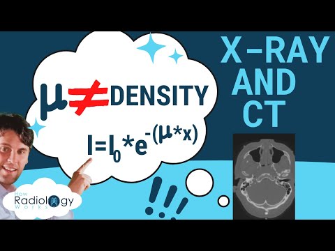X-ray Attenuation Coefficients | X-ray Attenuation Calculator | A level Medical Physics