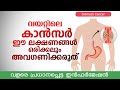 വയറ്റിലെ കാൻസർ ഈ 4 ലക്ഷണങ്ങൾ ഒരിക്കലും അവഗണിക്കരുത് | വളരെ പ്രധാനപ്പെട്ട ഇൻഫർമേഷൻ | Stomach cancer