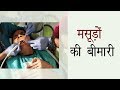 मसूड़ों की बीमारी | #Gum #Disease In #Hindi | #Healthyho