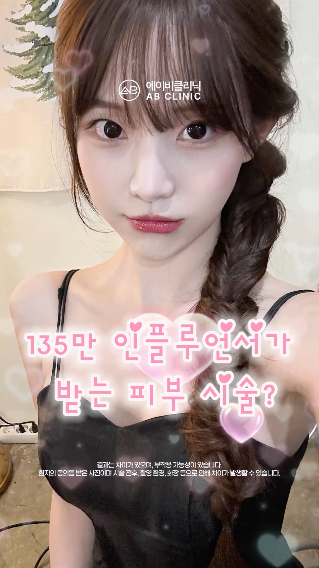 135만 인플루언서가 받는 시술
