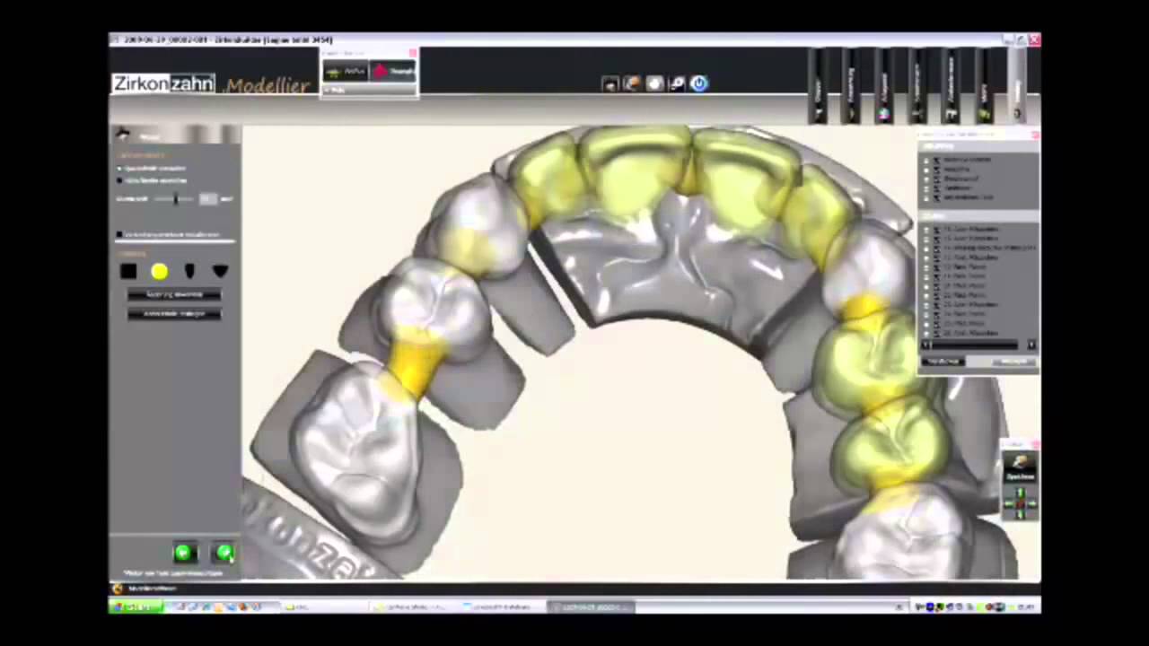 3D проектирование и моделирование зубных конструкций CAD CAM технологии