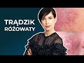 Trądzik RÓŻOWATY - rosacea. Jakie są jego przyczyny i jak dbać o skórę z trądzikiem różowatym?