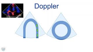 ASE 2021 Tissue Doppler and Strain Imaging