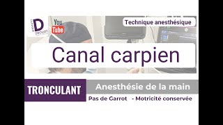 WALANT - Canal Carpien - technique anesthésie