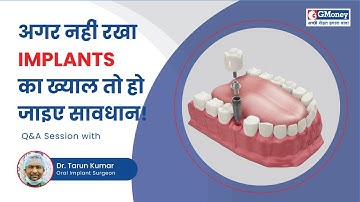 What is peri implantitis? [Treatment for Peri Implantitis] - GMoney Health Show