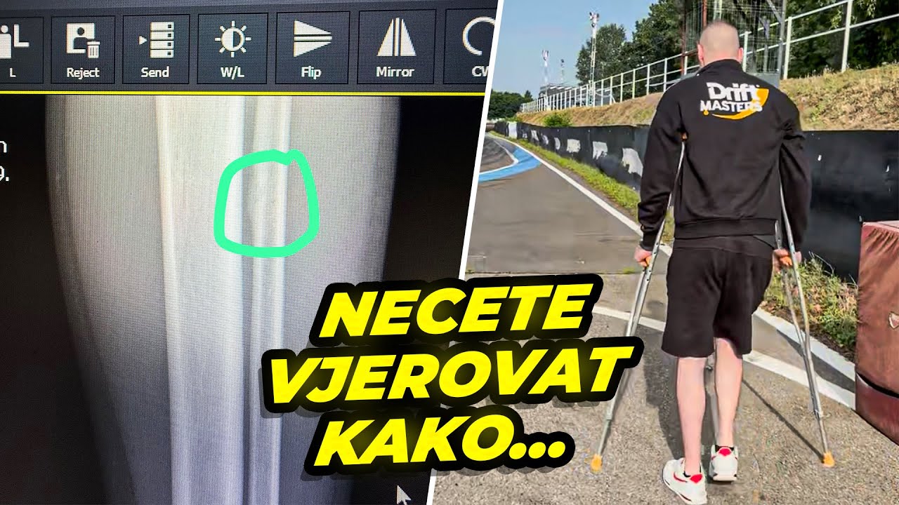 Slomia Sam Nogu Dan Prije Najvaznije Trke u Zivotu!!!