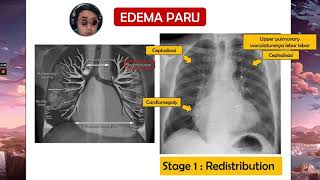 Step by Step Radiologi Thorax Bersama dr. Panjul (FK UGM) screenshot 5