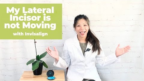 My Lateral Incisor is not following with the Invisalign trays!_ Dr. Yang