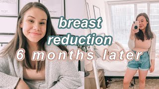 Breast reduction lolosavo Beautiful curvaceous Breast reduction lolosavo Beautiful curvaceous