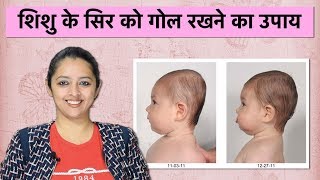 शिशु के सिर को गोल रखने का उपाय | Flat Head Prevention And Care