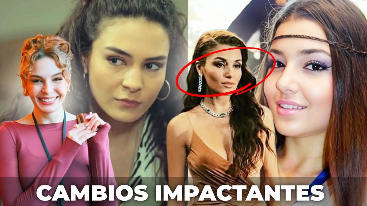 12 Actrices Turcas con cirugías plasticas y NO LO SABIAS 
