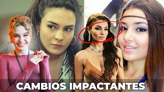 12 Turkish Actresses with Plastic Surgery and You Didn't Know It