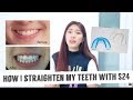 How I straighten my teeth with only $24 (Really effective)