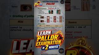 PALLOR EXAMINATION | General Physical Examination | MBBS Practical exams #anaemia #mbbs