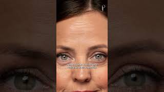 Existe idade mínima para usar toxina botulínica? Dra. Jéssica Peixoto Dermatologista Belo Horizonte