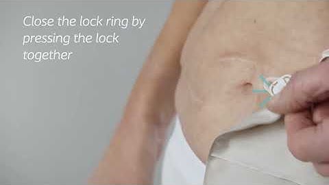 How to use SenSura Mio - Convex - Click Coupling - Closed Bag