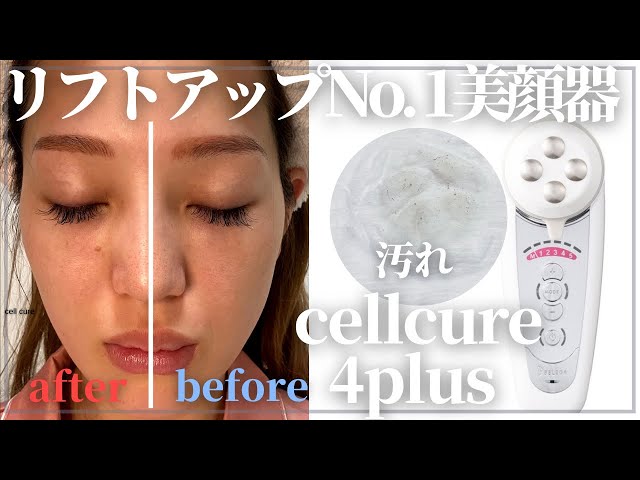 法令線が消える小顔美顔器】医療並の引き上げ‼️セルキュア4tプラスを