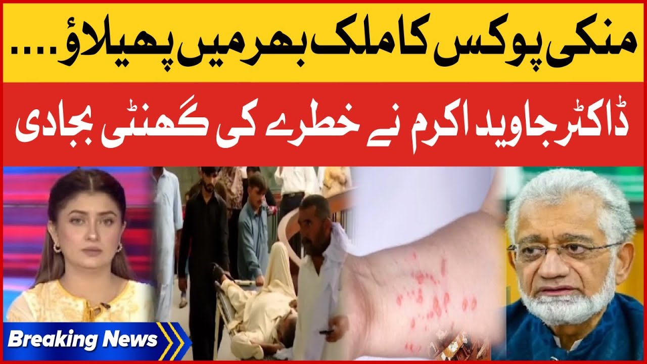 Monkey Pox Virus in Pakistan | Dr Javed Akram Big News | Breaking News ...