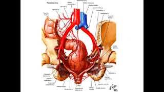 Pelvic Exenteration