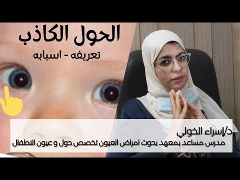 كل ما يخص الحول الكاذب عند الاطفال تعريفه و اسبابه