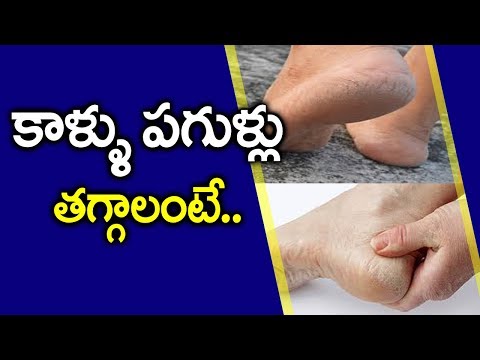 కాళ్లు పగుళ్లు తగ్గాలంటే ఏమి చేయాలి ? | How To Reduce Crack Heels | Vanitha  Tips |  Vanitha TV