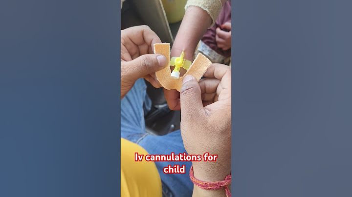 Iv cannulation for child #iv injection #shrorts #trending #nursing #doctor @drxsachin12