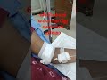 കീമോ ജീവിക്കാൻ എന്നെ തളർത്തുന്നു🥹