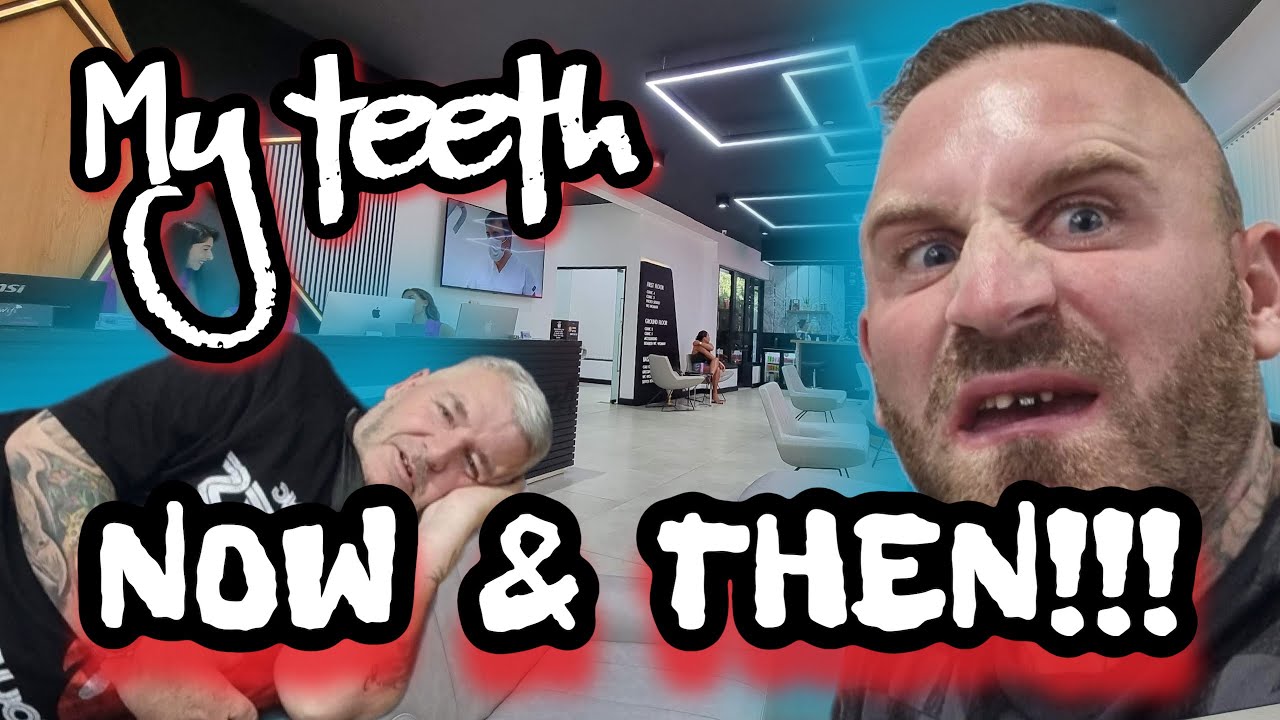 What happened to my teeth in turkey @ SEVIL SMILE !!!!