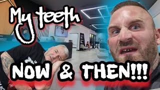 What happened to my teeth in turkey @ SEVIL SMILE !!!!