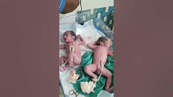 Twins baby after birth #cute #cutebaby