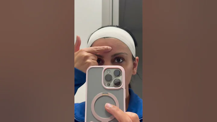 How to get rid of sebaceous hyperplasia bumps on face. #dermatologist