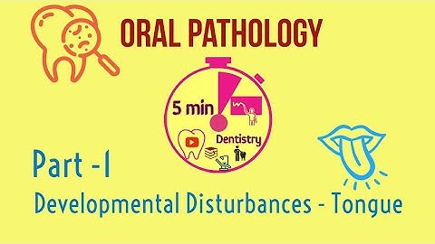 Developmental disturbances of tongue - Part 1 - 5 min Dentistry | ORAL PATHOLOGY