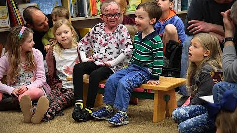 Meet Ella Murray: The 9-year-old with skin as deli...