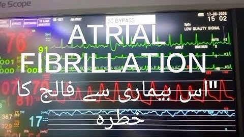 "Atrial Fibrillation on Monitor | Real-Time ECG Rhythm | Cardiac Awareness" @who