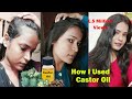 कैसे बाल Regrowth के लिए Castor Oil का उपयोग करे | Use Of Castor Oil For Hair Growth| Shinny Roops