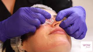 WOW facial Demonstration Video