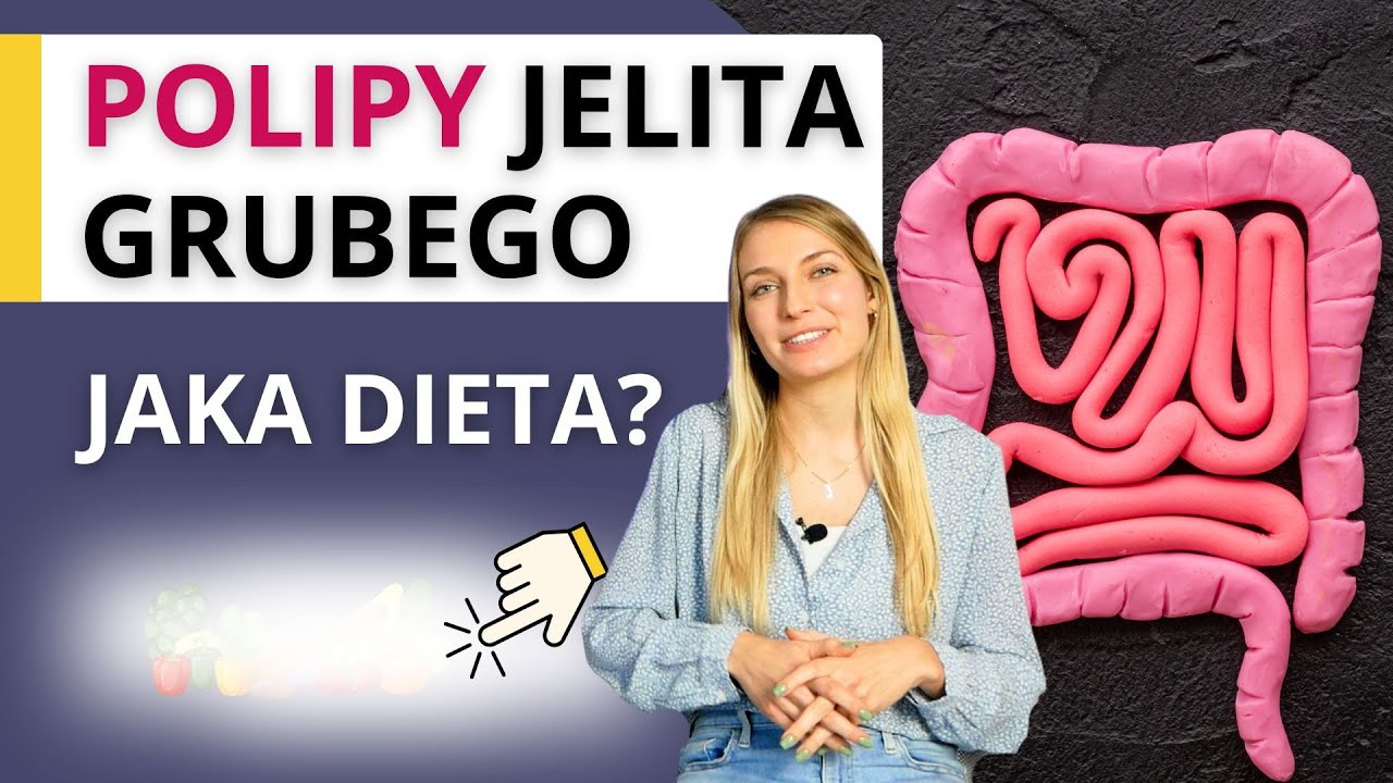 Dieta na polipy jelita grubego - co jeść, a czego unikać? Polipy - leczenie, diagnostyka, dieta