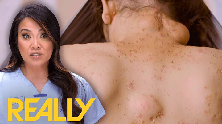 Dr. Lee Performs Surgery To Remove Cysts From This...