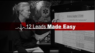 How to Read 12 Lead EKGs