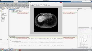 Matlab - dicom reader
