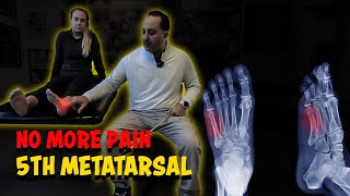 5th Metatarsel no More Pain
