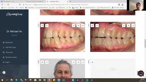 In Office Clear Aligner Seminar - Preview #5 Case & Task Management