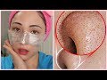 Testando A MELHOR TÉCNICA COREANA PARA REMOVER CRAVOS E SEBO DO NARIZ FUNCIONA?